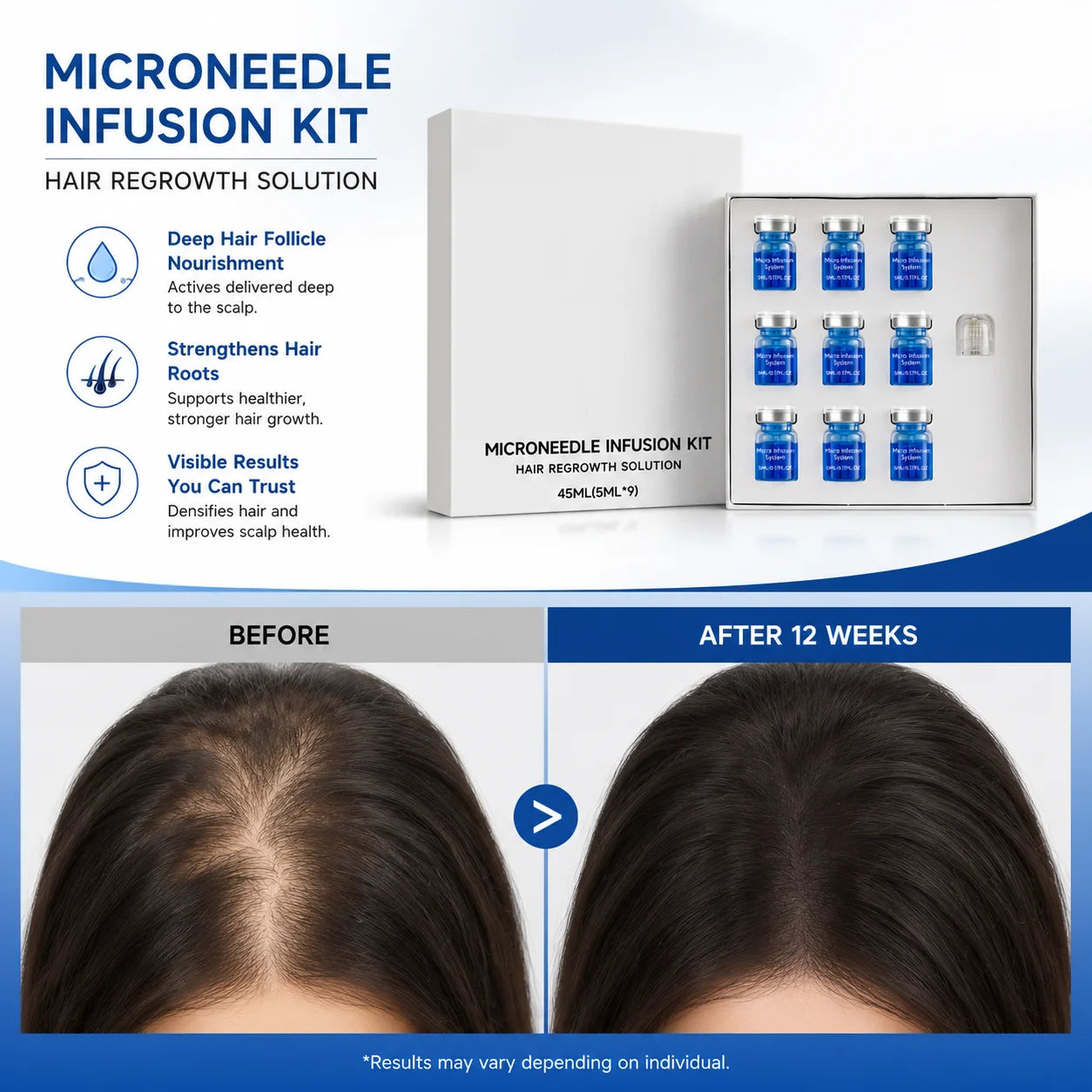 Kit de Microagujas para el Crecimiento del Cabello, Soluc...