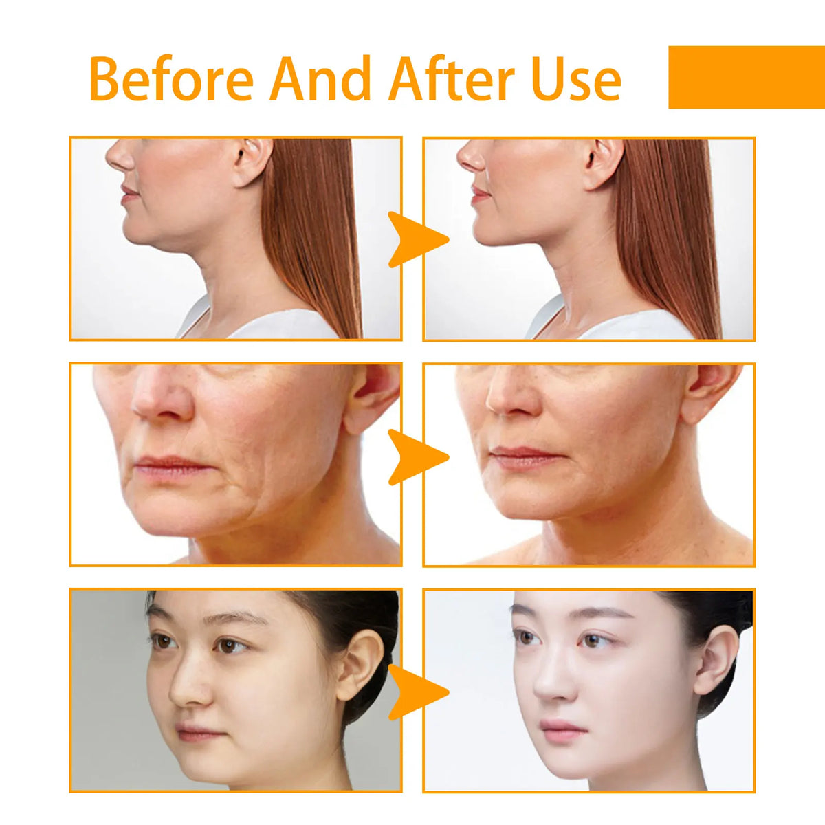 Crema Facial Rejuvenecedora con Cúrcuma, Antioxidante y A...